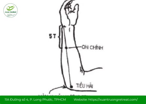 Xác định chính xác vị trí huyệt Chi Chính giúp trị liệu hiệu quả