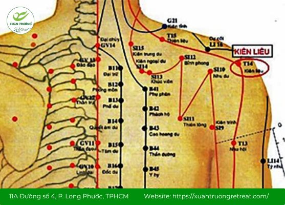Vị trí huyệt Kiên Liêu trong hõm sau mỏm cùng vai