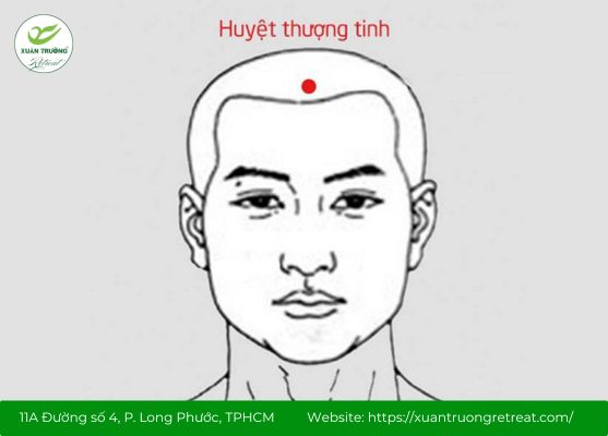 Huyệt Thượng Tinh giúp cải thiện sức khỏe toàn diện cho cơ thể