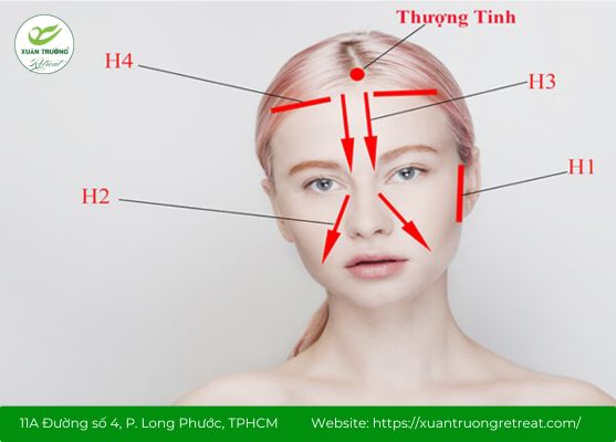 Xác định đúng vị trí huyệt Thượng Tinh trên khuôn mặt