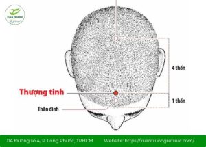 huyệt Thượng Tinh